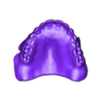 789513050_20240910_1101_Tech_01_-_H_total_B3_prerabka_1_Monoblock.stl DIGITAL TOTAL UPPER REMOVABLE DENTURE - 3 stl files (base + teeth + monoblock)
