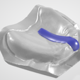 Dental-Roy-Mac-Gregor's-Spacer-2.png ESPACIADOR DENTAL COLECCIÓN 1