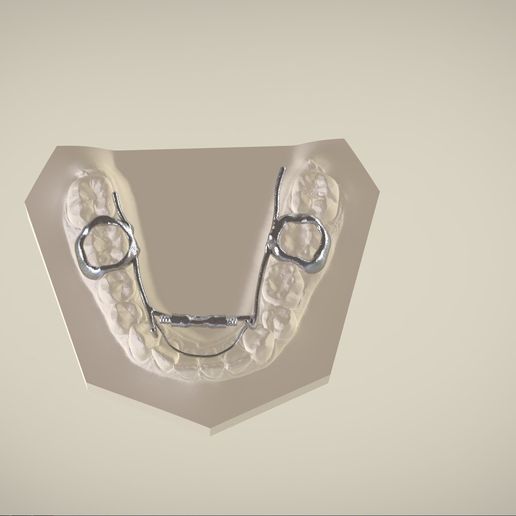 Snapshot_2017-3-1_13-13-32.jpg Digital Dr. Williams's Ortho Appliance