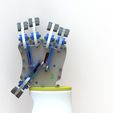 Untitled4.jpg Smart Prosthetic Hand: A Revolution in Prosthetic Technology