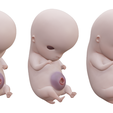 6_Weeks_Color.png 3D file 6 Weeks Human embryonic (baby stages)・3D print model to download