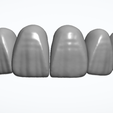 Screenshot-2024-12-01-205015.png All Collection For exocad