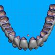 03.jpg Teeth for temporary crowns - maxillary+mandibular-teeth