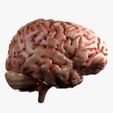 Side2.jpg Human Brain