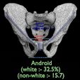 pelvis-types-hip-bone-labelled-detailed-3d-model-affa15aea4.jpg Pelvis types hip bone labelled detailed 3D model