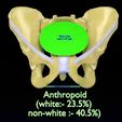 pelvis-types-hip-bone-labelled-detailed-3d-model-9b5cb4f9f2.jpg Pelvis types hip bone labelled detailed 3D model