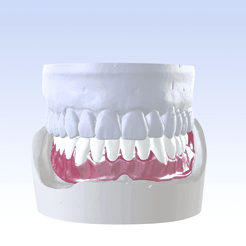 2.png Digital Single Jaw Full Denture