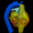 8.png 3D Heart Anatomy with Codominance