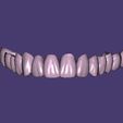 Capture.jpg STL-Datei Dental Bridge FULL ARCH・Design zum Herunterladen und 3D-Drucken