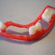 DSCN0285.JPG dental partial dentures