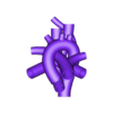 ARSA-V2-shelled.STL Aberrant right subclavian artery anomaly 3D print model