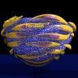 file-10.jpg Caseating granuolma tuberculosis labelled 3D model