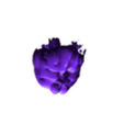 TUMOR.stl 3D CÁNCER DE CUELLO UTERINO CON ÚTERO, GANGLIOS LINFÁTICOS, SISTEMA URINARIO, VÉRTEBRAS Y PELVIS