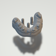 1modelbase.png Dental project complete