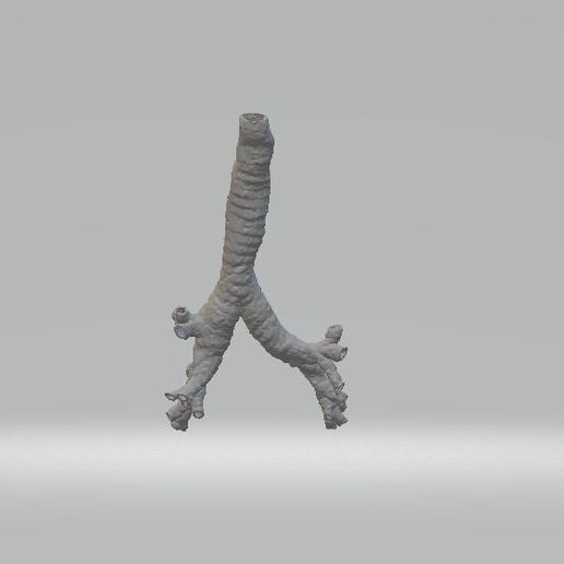 Vias aereas de un paciente real // Airway of a real patient