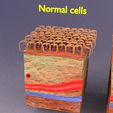 0515.jpg adaptation epithelial cell changes normal to cancer Low-poly 3D model