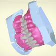 Screenshot_16.png Full Dentures with Many Production Options