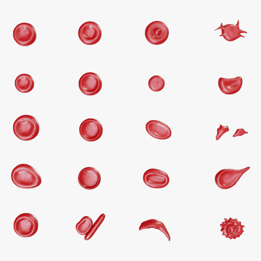 🩸 Red Blood Cell Morphology Normal and Abnormal Erythrocyte Structures ...
