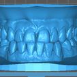 DENISSE-CAMACHO.jpg Dental Model/ Dental Model