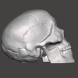 Cracked-Skull-Pic-4.jpg Cracked Skull