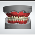 26.png Digital Full Dentures with Combined Glue-in Teeth Arch