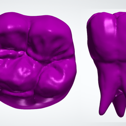 molarpic.png Maxillary First Molar II with Rootform