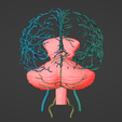 18.png 3D Model of Brain and Aneurysm
