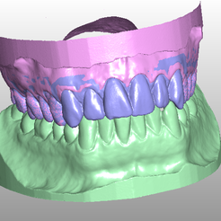 modelo.png STL file Complete dental model・3D printable model to download