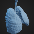 HLC_Render6.png Human Lung Cancer