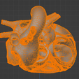 21.png Modèle 3D de la valve aortique bicuspide (BAV)