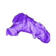 STL00001.stl 3D Model of Human Heart with Double Outlet Right Ventricle (DORV) - generated from real patient