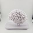 20251231_113111-1.jpg Sección transversal del cerebro