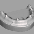 Captura-de-tela-2023-10-24-112755.png dental prosthesis