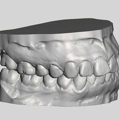 Imagen3.jpg Ready-to-print dental practice models
