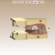 Screenshot_1.png Digital Quadrant Model with 3Shape Articulator Interfaces