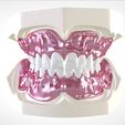 12.jpg STL file Digital Full Dentures for Gluedin Teeth with Manual Reduction・3D printable design to download