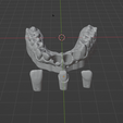 1.png Dental model with removable dies