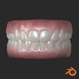 03_BLENDER.jpg Human teeth with gums