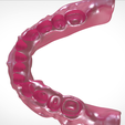 Screenshot_10.png Digital Full Dentures for Gluedin Teeth with Manual Reduction
