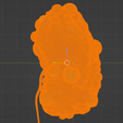 34.png 3D Model of Polycystic Kidney