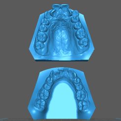 XIOMARA-MARTINEZ12.jpg STL file Dental Model/ Dental Model・3D printer design to download