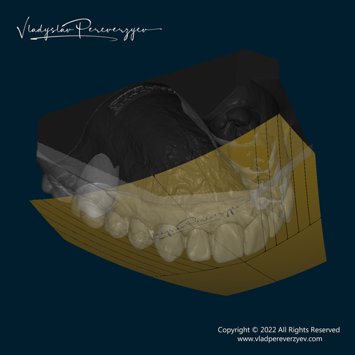 👑 Curva de Monson - Software・Archivo STL para Impresión 3D・Cults