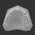 Capture d’écran 1.png teeth, dent, dental, dental, denti, bocca, Zahn,