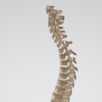 FULL-VERTEBRA-10.png 3D CÁNCER DE CUELLO UTERINO CON ÚTERO, GANGLIOS LINFÁTICOS, SISTEMA URINARIO, VÉRTEBRAS Y PELVIS