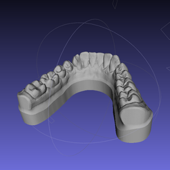 1MI.png Dental model, mouth, teeth