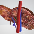 FATTY-LIVER,-Steatosis,-Steatohepatitis,-abdominal,-abdomen,-pancreatic,-biliary,-hepatic,-artery,.png 6 PIÈCES Modèle 3D réaliste du foie gras - avec système biliaire, veines portales, veines et artères hépatiques, ligaments du foie