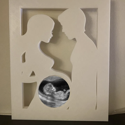 Captura-de-Pantalla-2022-11-29-a-las-0.45.49.png Ultrasound baby couple baby picture