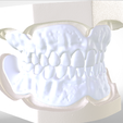 7.png Digital Try-in Full Dentures for Injection Molding