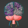 7.png 3D Model of Brain and Aneurysm