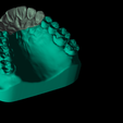 Screenshot_12.png Phantom dental model for dental technicians